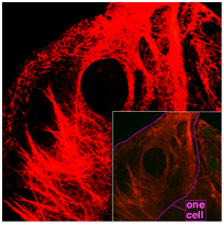 What is the definition and Function of Cytoskeleton? Intermediate filaments