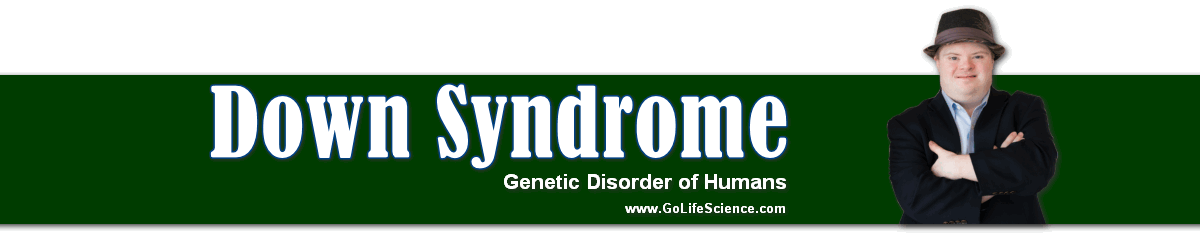 Down Syndrome: Genetic Disorder of Humans down syndrome